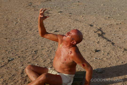 Leper Crying Out to God