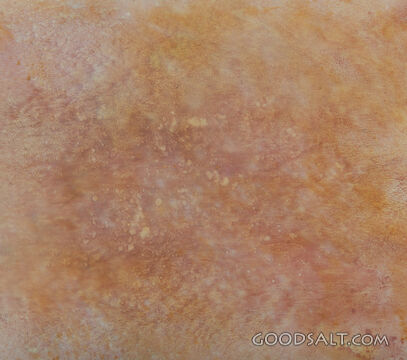 Texture
